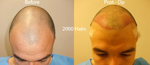 Andras-2000-hairs