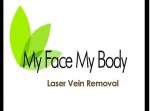 Laser Vein Removal