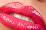 Lip filler offer