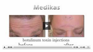 Cosmetic Treatments by Medikas Medispa Bath