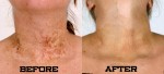 recell before and after