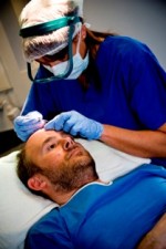 hair transplant