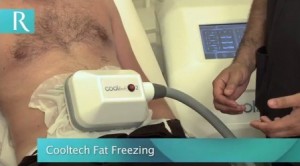 fat freezing