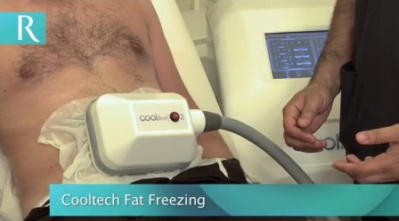 Cooltech fat freezing